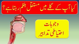 Top Causes of Constant Mucus Phlegm In Your Throat Patienteducation [upl. by Godderd]