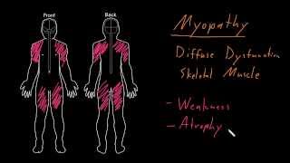 Syndrome Myopathy [upl. by Eilyw294]