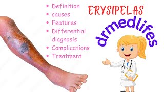 Erysipelas causes symptoms differential diagnosis complications treatment [upl. by Aneis]