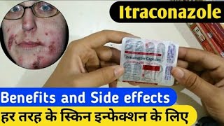 Itraconazole capsules use in hindi review [upl. by Cole]