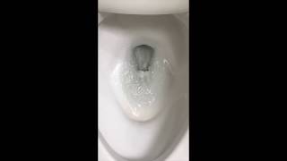 Unclog Toilet Bowl Siphon Jet Hole to Improve Flushing [upl. by Annoif]