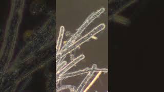 Coenocytic Hyphae [upl. by Nerot]