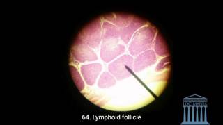 Histology  Vermiform Appendix [upl. by Niliak]