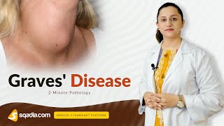 Graves Disease  Medical Pathology Video  Online Education  VLearning™ [upl. by Nylaehs]