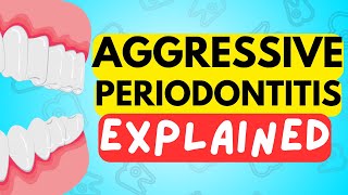 AGGRESSIVE PERIODONTITIS EXPLAINED IN 5 MINUTES  CAUSE DIAGNOSIS RISK FACTORS AND TREATMENT [upl. by Asilat]