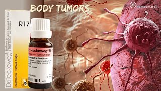 Shrink Tumors Naturally Unveiling Dr Reckewegs R17 Homeopathy Drops [upl. by Gewirtz162]