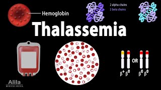 Thalassemia Alpha amp BetaThalassemias Genetics Pathophysiology Diagnosis amp Treatment Animation [upl. by Navaj]