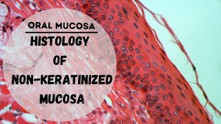 Histology of Oral Mucosa  Histology of Lining Mucosa [upl. by Atteloj]