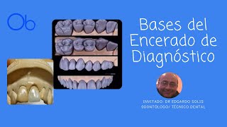 Morfología Dental y Encerado de Diagnóstico [upl. by Nnylhsa]