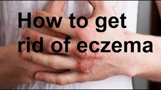 Effective Remedies for Eczema [upl. by Burnside]