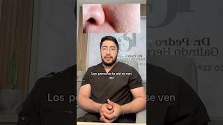 Poros dilatados dermatólogo skincare dermatologia dermatologo piel skincareroutine [upl. by Aronael]