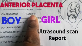 Anterior Placenta Baby GenderUltrasound Scan Report [upl. by Spalding]