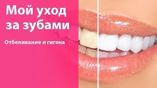 Белизна и здоровье зубов — мои простые способы [upl. by Elnore955]