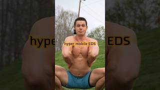 Hypermobile EDS whealth stayflexy [upl. by Winfred]