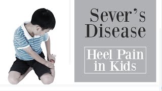 Sever’s Disease  heel pain in children [upl. by York]