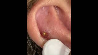 Piercings en apuros piercing piercer videopiercing failpiercing [upl. by Bonnette]