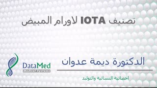 محاضرة الدكتورة ديمة عدوان تصنيف IOTA الاورام المبيض [upl. by Nae]