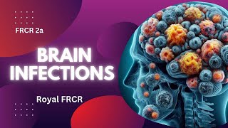 7  Neuroimaging for FRCR [upl. by Amr]