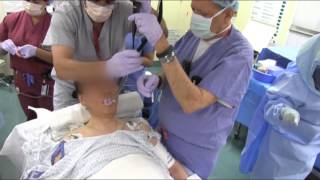 Severe Arthritic Syndrome Awake Intubation from AOD [upl. by Eiaj]