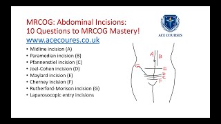 Abdominal incisions for the MRCOG exam MRCOG Mastery in 10 Questions Series from ACE Courses [upl. by Cordle865]