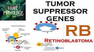 NEOPLASIA 3 TUMOR SUPPRESSOR GENES Retinoblastoma Gene Knudsons Two Hit Hypothesis [upl. by Alton]