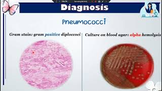 Practical Diagnosis of meningitis [upl. by Conroy]