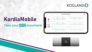 Kardia Mobile  Easy amp Reliable ECG Monitoring Anytime Anywhere [upl. by Sihtam664]