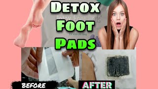 EFFECTS OF USING DETOX FOOT PADS amp HOW TO USE IT [upl. by Ertha]