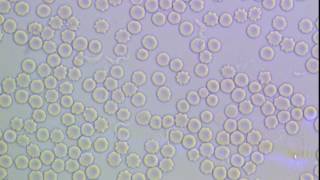 Trypanosoma brucei in mammalian blood [upl. by Notgnilra150]