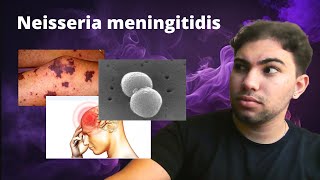 Neisseria Meningitidis  Meningite Meningocócica e Meningococcemia grave [upl. by Ahsinyar448]