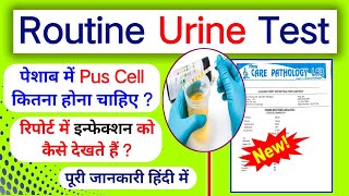 Routine Urine Test Report Kaise dekhe।।Pus Cell in urine।।Pus Cell kya hota hai।। [upl. by Aneerak775]