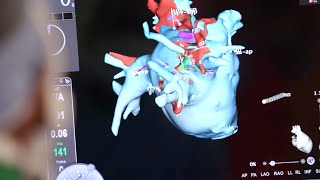 Mayo Clinic Minute What is cardiogenic shock [upl. by Malamut201]