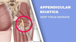 Sciatic Pain  Deep Tissue Massage for Appendicular Sciatica [upl. by Ibbie155]