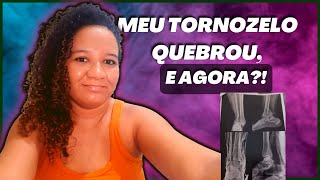 TORNOZELO QUEBRADO  MEU RELATO fratura trauma tornozelo [upl. by Assina]