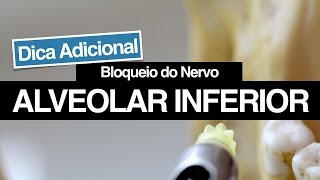 Bloqueio do Nervo Alveolar Inferior  Dicas Adicionais Para Aumentar o seu Sucesso [upl. by Darren]