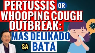 Pertussis or Whooping Cough Outbreak Mas Delikado sa Bata  Tips By Doc Willie Ong [upl. by Nywrad]