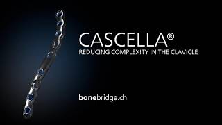 Bonebridge CASCELLA® reducing complexity in the clavicle [upl. by Thurmond290]