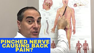 Does A Pinched Nerve In The Neck Cause Upper Back Pain  Dr Walter Salubro Chiropractor In Vaughan [upl. by Maiga945]