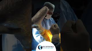 What is Robotic Joint Replacement Surgery  Explained by Dr I Satish Raju [upl. by Renate]