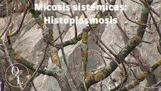 10 Micosis sistémicas Histoplasmosis [upl. by Grati]