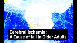 Cerebral Ischemia A Cause of fall in Older Adults [upl. by Thurlough]