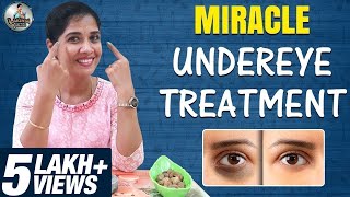 Miracle Under Eye Treatment  Home remedy for Dark Circles  Lakshya Junction [upl. by Ailes]