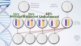 Genetics Presentation  Balance Translocation [upl. by Teirrah747]