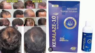 KERALAZE 10 Topical Solution Minoxidil Topical Solution [upl. by Savil46]