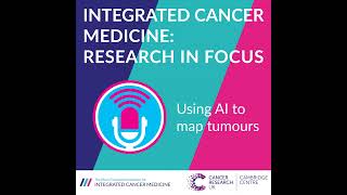 Using AI to map tumours The InnerEye Project [upl. by Asiluj513]