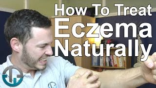 How To Treat Eczema Naturally [upl. by Mallina]