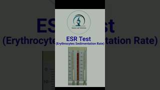 ESR Test Erythrocytes Sedimentation Rate  Hematology Test  Normal value pathologylab [upl. by Gould416]