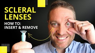 Scleral Lenses Insertion And Removal Plus Pro Tips For Beginners [upl. by Fred]