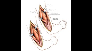 Posterior Approach to Humerus [upl. by Sivehc]