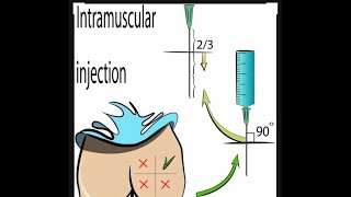 How to give Intramuscular injection in Gluteal region 💉🩸 injection medicos medical [upl. by Marquez471]